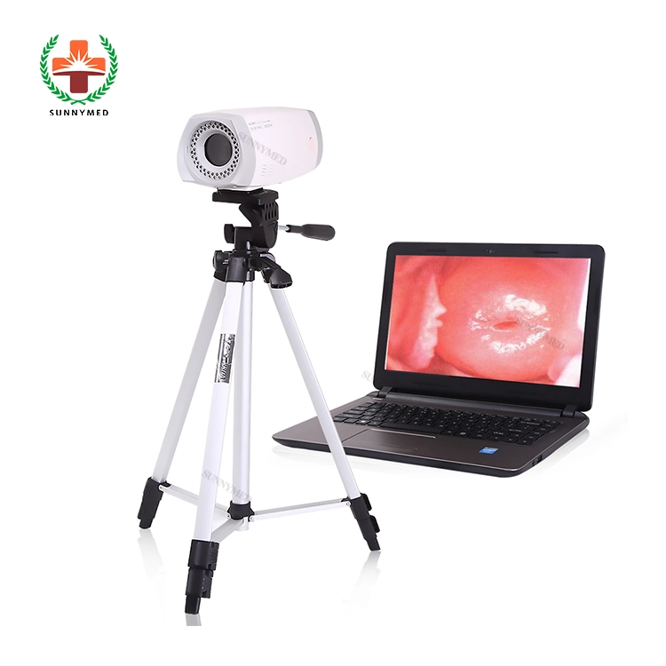 Sy-F003 Guangzhou Delivery Electronic Colposcope for Gynecologic Examination