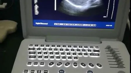 Escáner de ultrasonido portátil digital B/N del hospital para ginecología y ginecología
