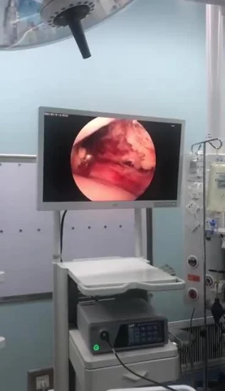 Instrumento laparoscópico del equipo médico del endoscopio laparoscópico